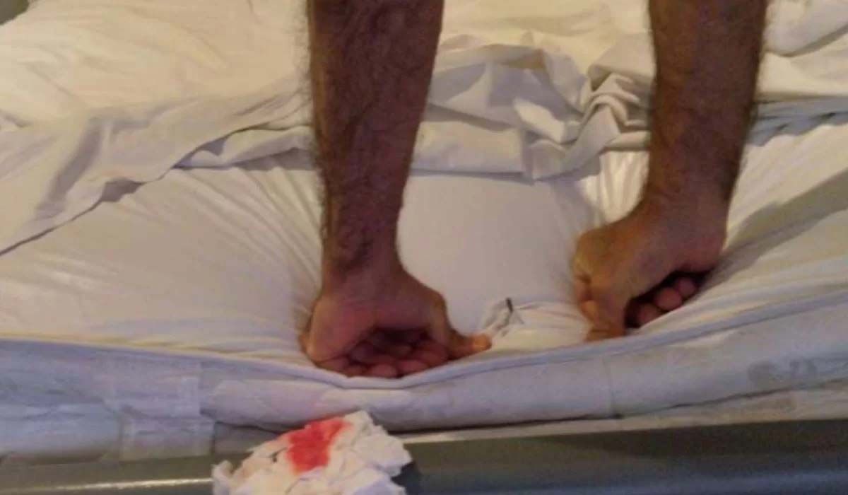 Cliente que furou joelho em cama de motel receberá indenização